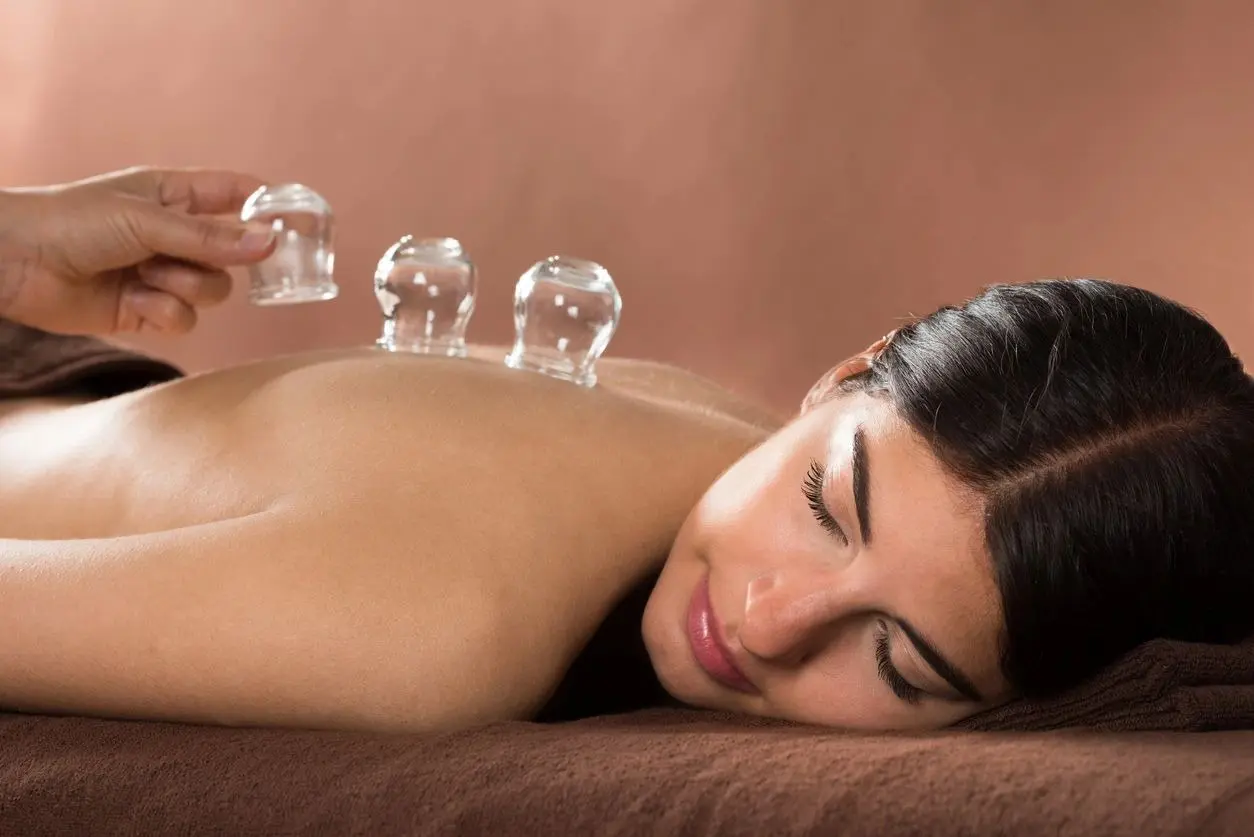 Woman Getting Cupping Treatment At Spa